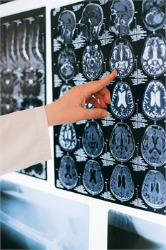 Unlocking the World of Interventional Radiology Careers